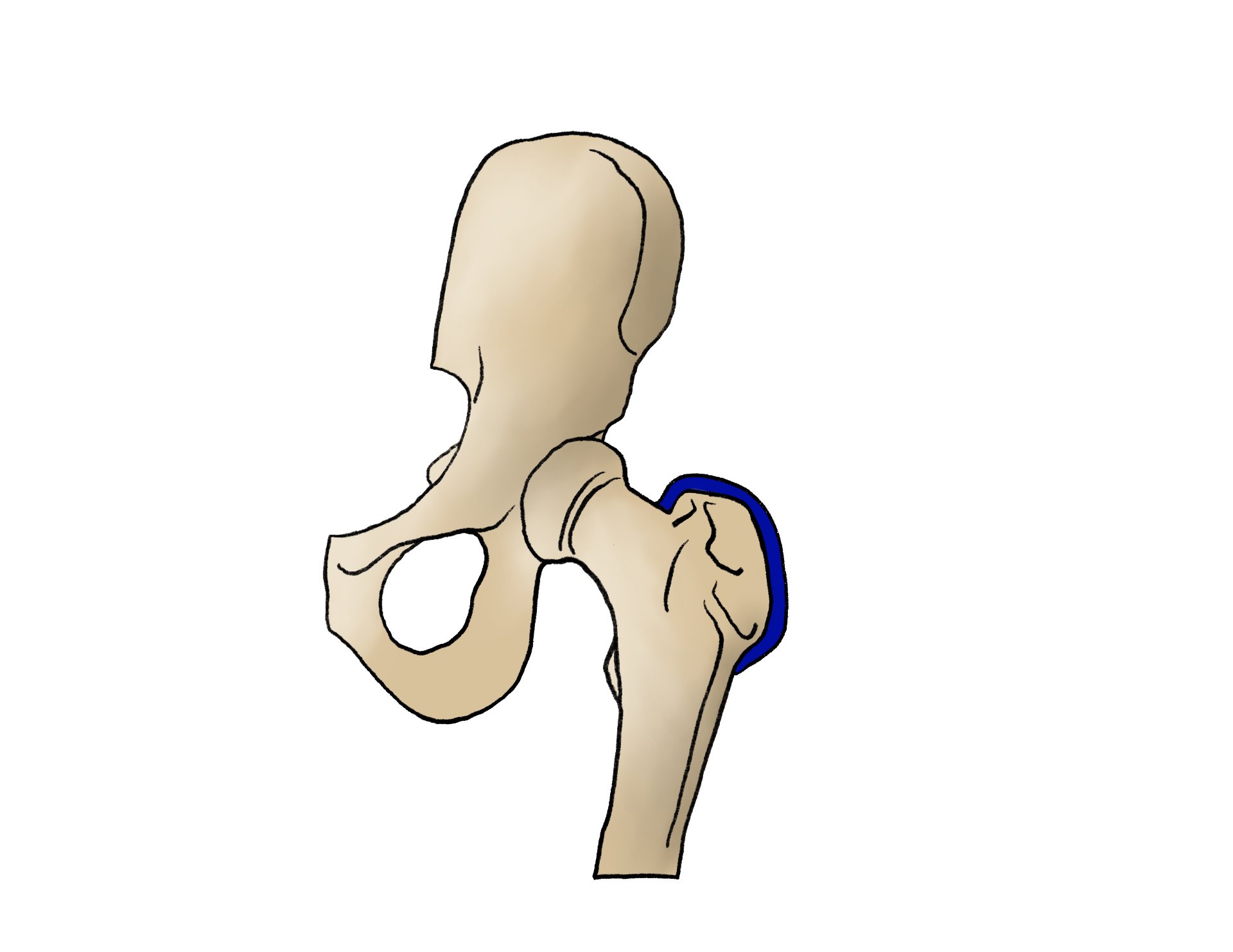 Fellow's drawing of the hip joint with the femoral head cartilage highlighted