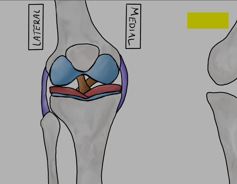 Fellow's drawing of knee joint anatomy with medial and lateral labels, menisci and ligaments